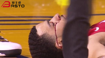 NBA硬汉范乔丹无防护眼镜,眼角受伤仍奋力夺杯